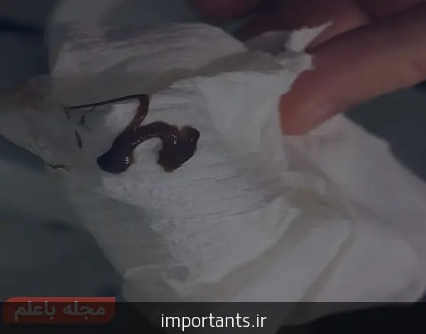 علت پریود نشدن چیست نی نی سایت