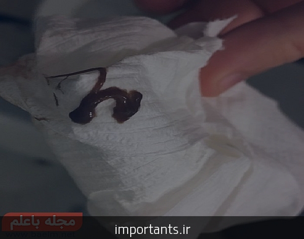 علت کم شدن خون پریود