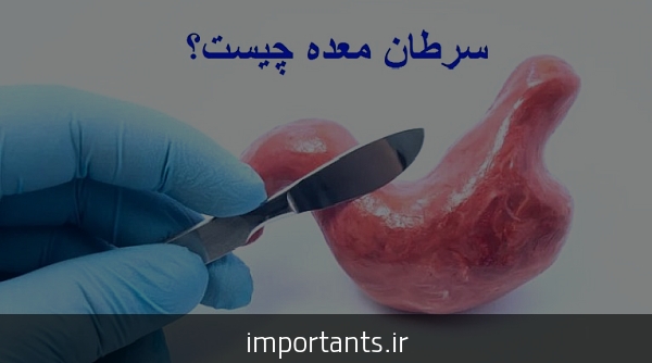 پرايد علت لرزش معده